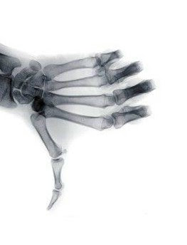 Pollice verso X-Files? 